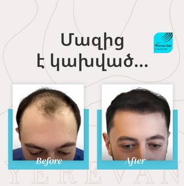 Slider image (6) United Hair Clinic